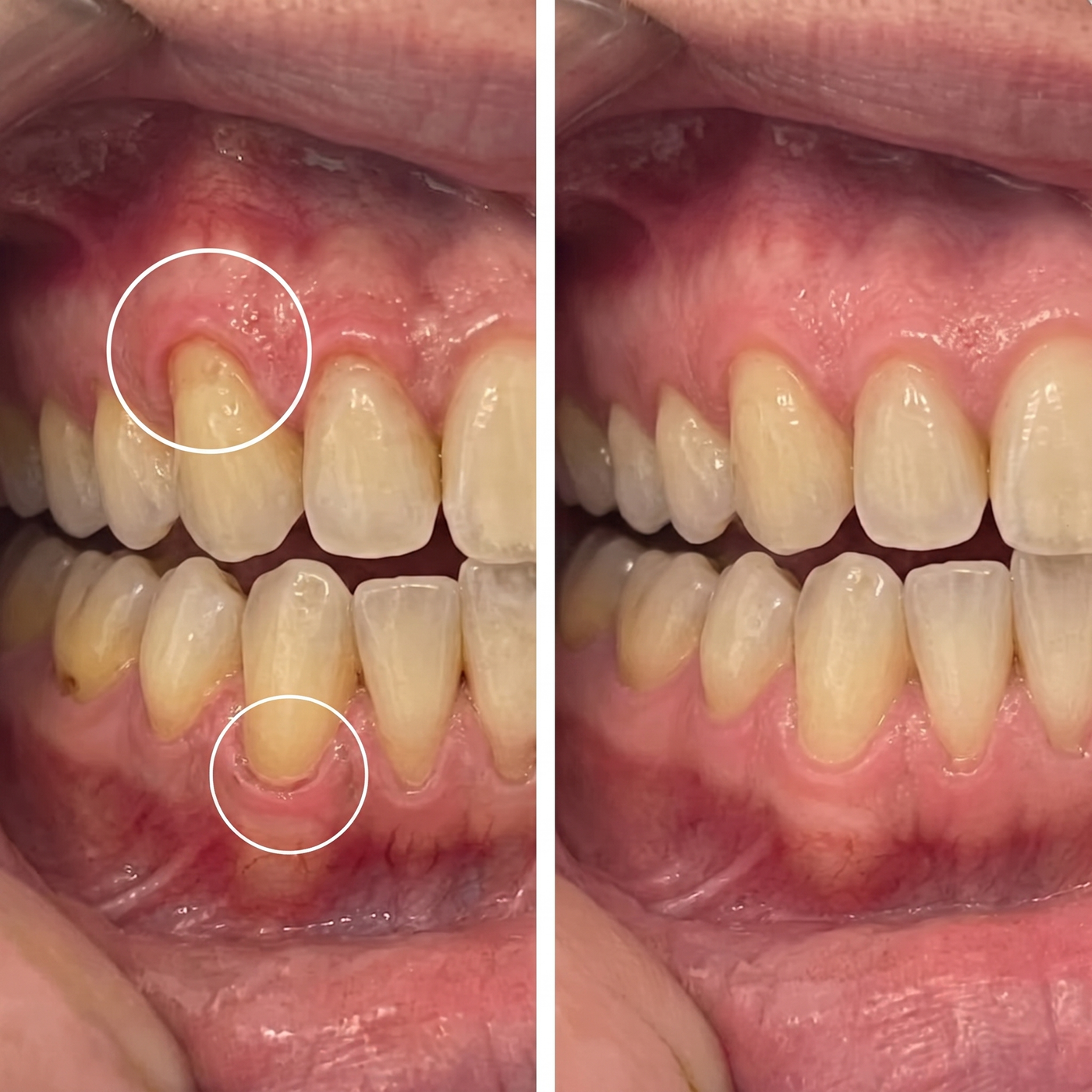 Colla Gum® Polvo de Colágeno para Encías
