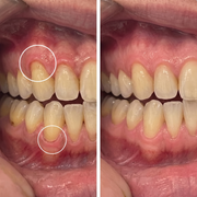 Colla Gum® Polvo de Colágeno para Encías