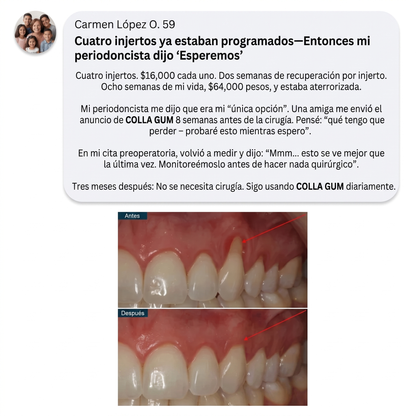 Colla Gum® Polvo de Colágeno para Encías