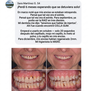 Colla Gum® Polvo de Colágeno para Encías