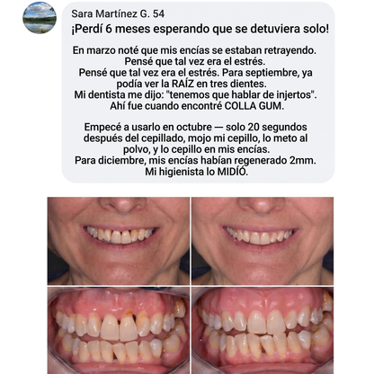 Colla Gum® Polvo de Colágeno para Encías